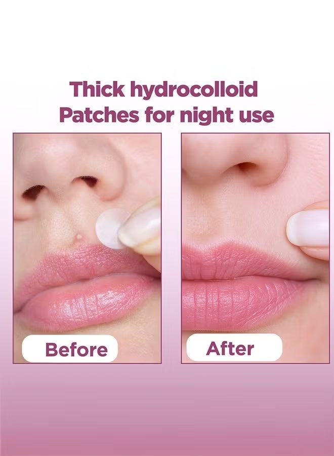 Floren Amazing Overnight Acne Patch | 28 Patches, 3 Sizes (8mm, 10mm, and 12mm) | Thick Hydrocolloid Acne Patch | More Effective with Extra Adhesion for Wound/Acne Healing | Acne Patch Stickers | South Korean Skincare | Drug-Free - Image 5